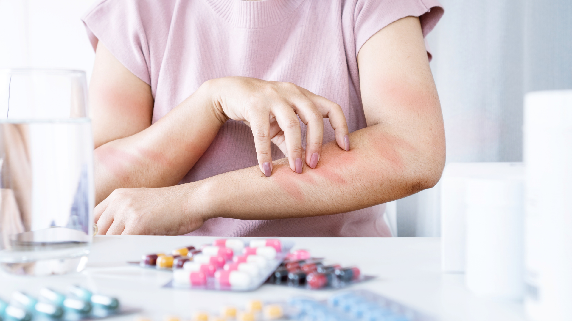 Tip 4: Monitor for Side Effects – 360° SCD Hub